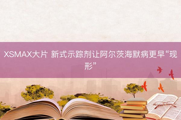 XSMAX大片 新式示踪剂让阿尔茨海默病更早“现形”